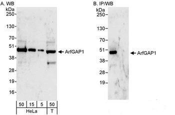 Rabbit ArfGAP1 Antibody