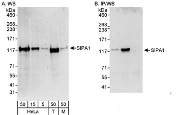 Rabbit SIPA1 Antibody