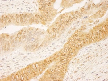 Rabbit anti-RanGAP1 Antibody