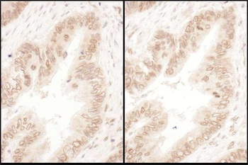 Rabbit anti-RanGAP1 Antibody