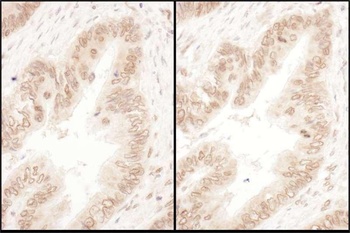 RanGAP1 Antibody