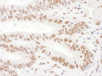 Rabbit anti-KSRP Antibody