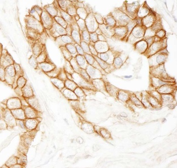 Rabbit anti-beta Catenin Antibody