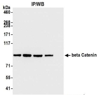 Rabbit anti-beta Catenin Antibody