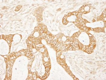 Rabbit beta Catenin Antibody