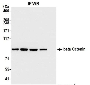 Rabbit beta Catenin Antibody