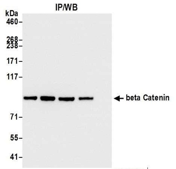 Rabbit beta Catenin Antibody