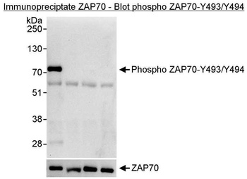 ZAP70, Phospho (Y493/Y494) Antibody