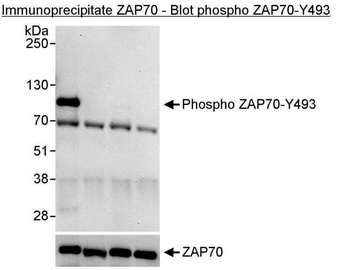 Rabbit anti-Phospho ZAP70 (Y493) Antibody