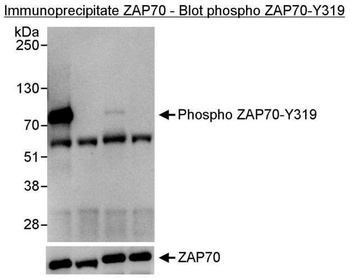 Rabbit anti-Phospho ZAP70 (Y319) Antibody
