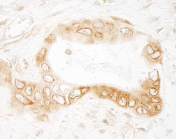 Rabbit anti-UVRAG Antibody