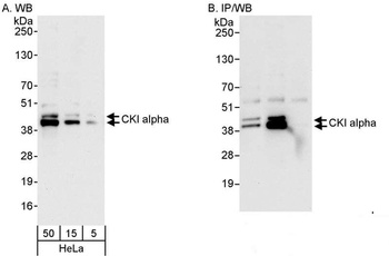 Rabbit CKI alpha Antibody