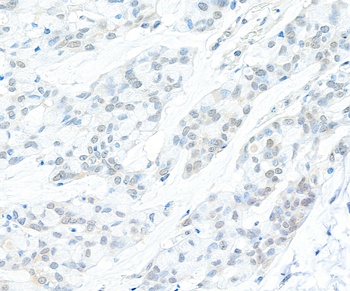 Rabbit anti-Cyclin C Antibody