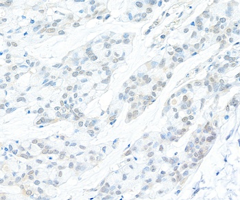 Cyclin C Antibody