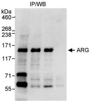 Rabbit ARG Antibody