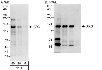 Rabbit ARG Antibody