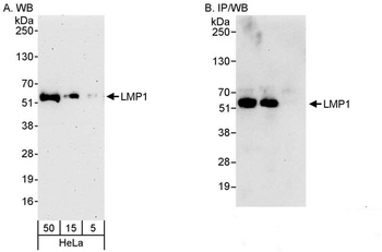 Rabbit LMP1 Antibody