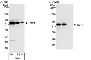 Rabbit LMP1 Antibody