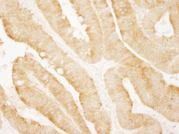 Rabbit anti-vPARP Antibody