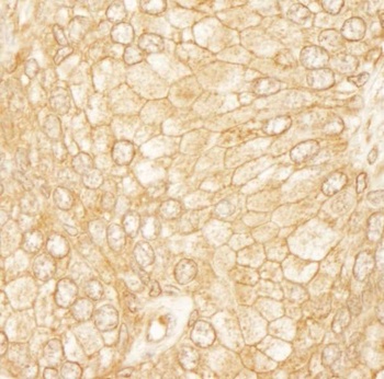 Rabbit anti-PDZ-RhoGEF Antibody