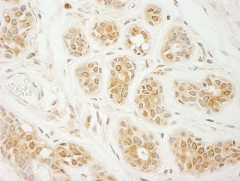 Rabbit eIF2A Antibody