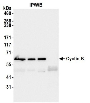 Cyclin K Antibody