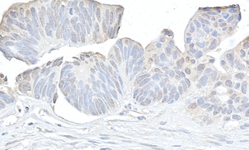Rabbit anti-Cyclin K Antibody