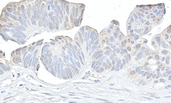 Cyclin K Antibody