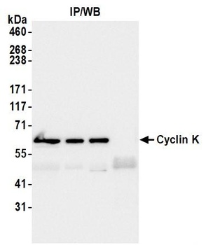 Rabbit anti-Cyclin K Antibody