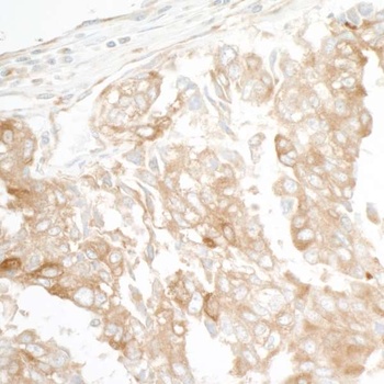 Rabbit GEF-H1 Antibody