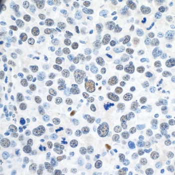 Rabbit anti-ZEB1 Antibody