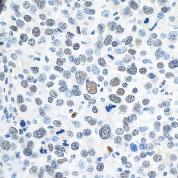 ZEB1 Antibody