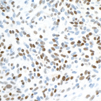 Rabbit anti-ZEB1 Antibody