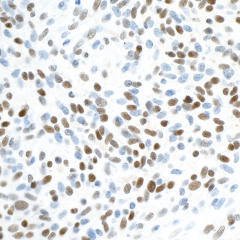 ZEB1 Antibody