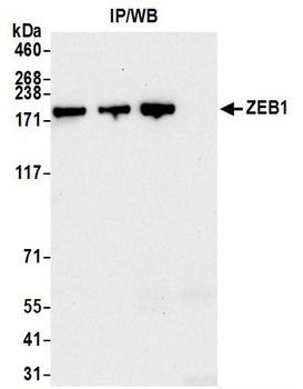 Rabbit anti-ZEB1 Antibody