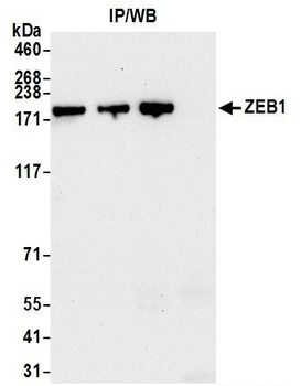 ZEB1 Antibody