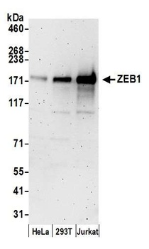 Rabbit ZEB1 Antibody