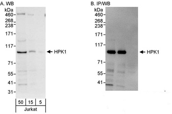Rabbit HPK1 Antibody