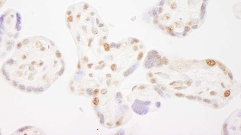 COBRA1 Antibody