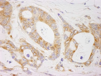 Rabbit anti-EML4 Antibody