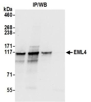 EML4 Antibody