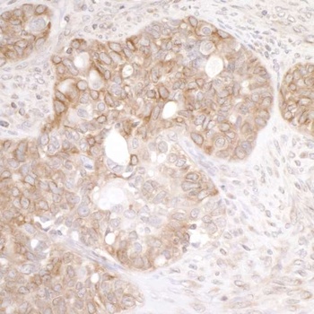 Rabbit anti-EML4 Antibody