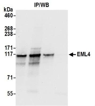 Rabbit anti-EML4 Antibody