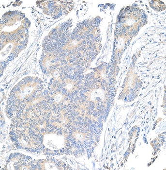 Rabbit Notch1 Antibody