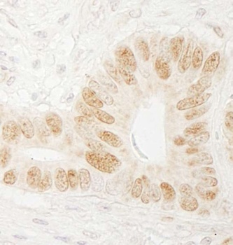 Rabbit anti-CTF18 Antibody