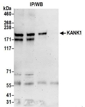 KANK1 Antibody