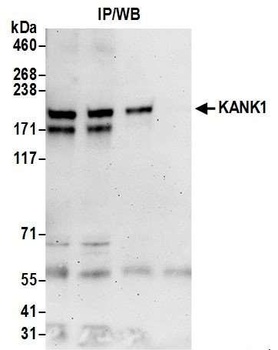 Rabbit anti-KANK1 Antibody