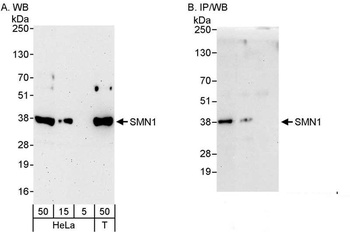 Rabbit SMN1 Antibody