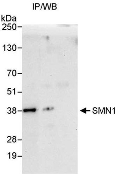 Rabbit SMN1 Antibody