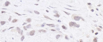 RPC2 Antibody